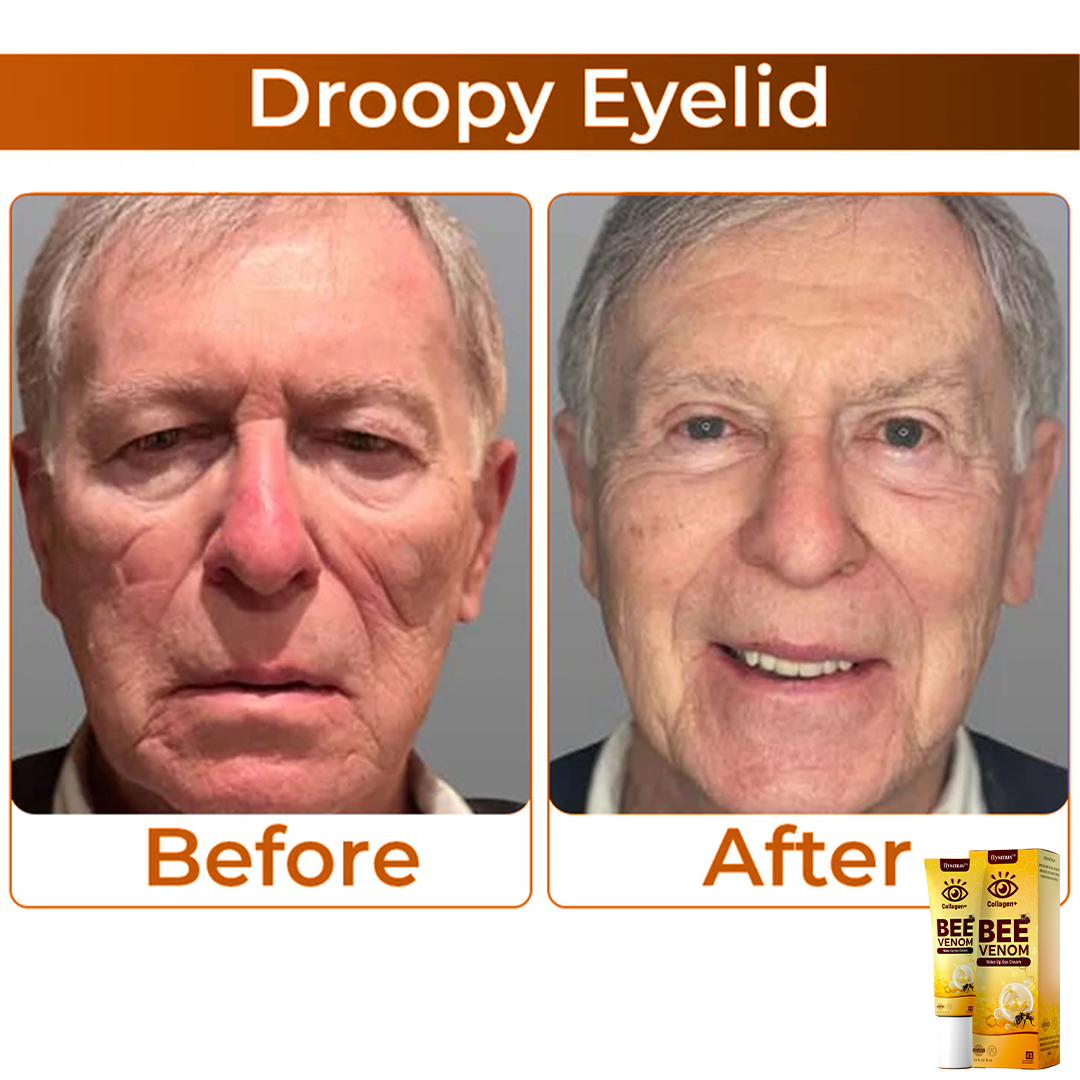 Bienengift+Kollagen : Wecken Sie Ihren Blick