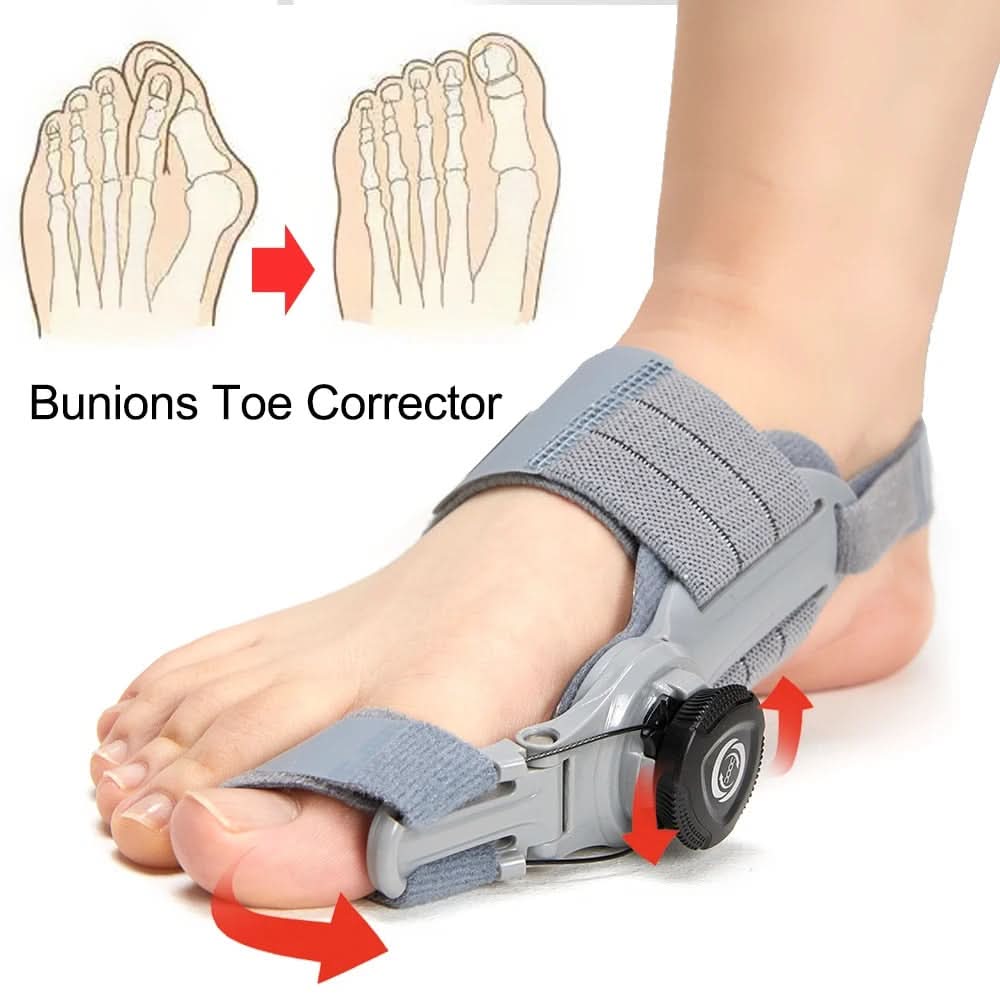 Correggi i tuoi bunions senza dolore né intervento 